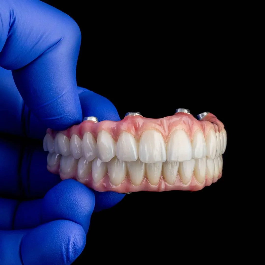 Dental prostheses-nobel